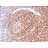 Immunohistochemistry - Anti-CD48 Antibody [CD48/4787] (A277861) - Antibodies.com