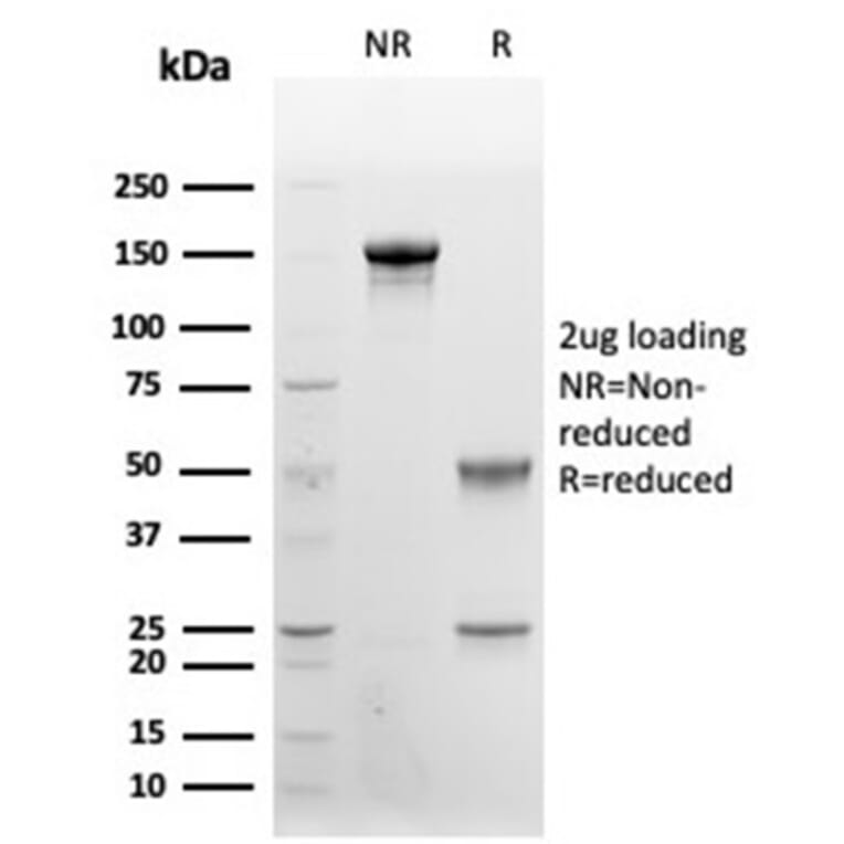 SDS-PAGE - Anti-CD48 Antibody [CD48/4787] (A277861) - Antibodies.com