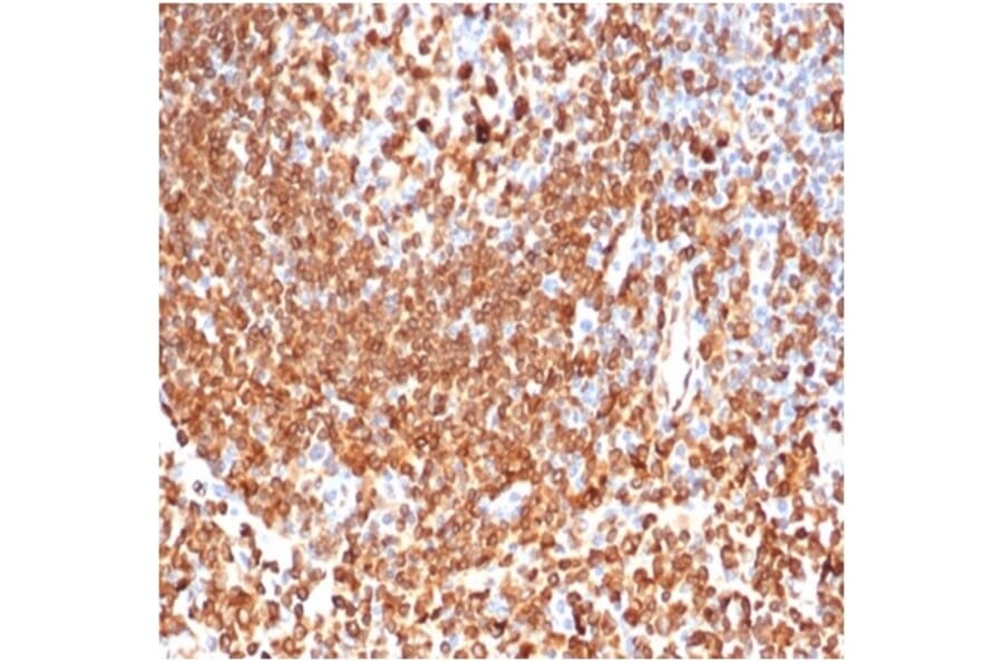 Immunohistochemistry - Anti-CD74 Antibody [CLIP/6609] (A277863) - Antibodies.com