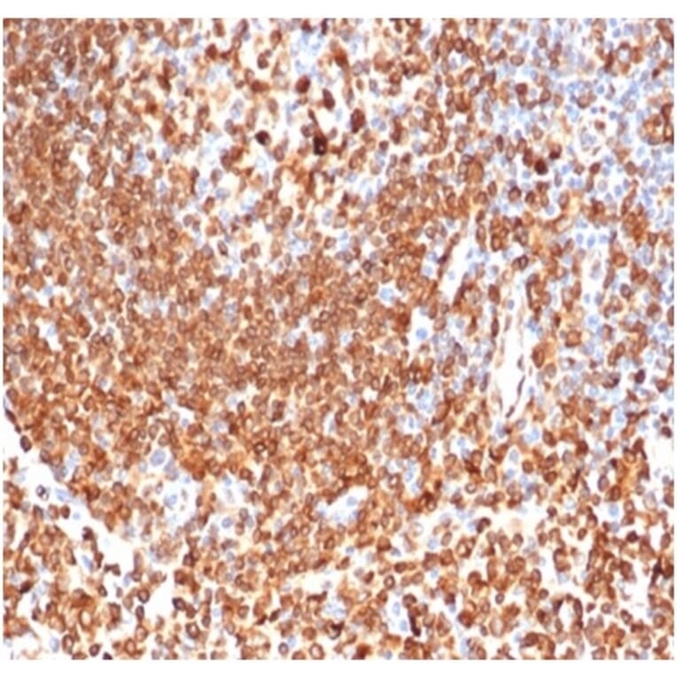 Immunohistochemistry - Anti-CD74 Antibody [CLIP/6609] (A277863) - Antibodies.com