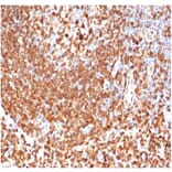 Immunohistochemistry - Anti-CD74 Antibody [CLIP/6609] (A277863) - Antibodies.com