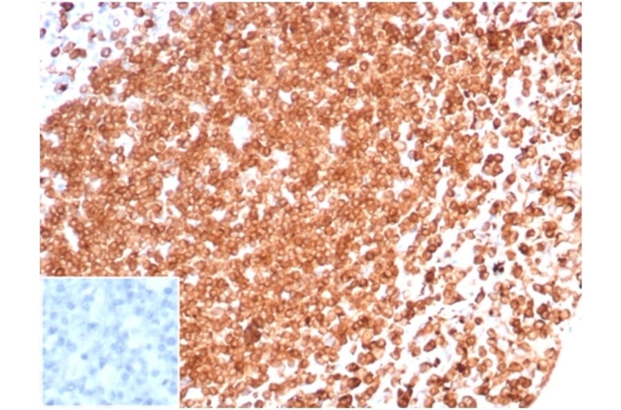 Immunohistochemistry - Anti-CD74 Antibody [CLIP/6609] (A277863) - Antibodies.com
