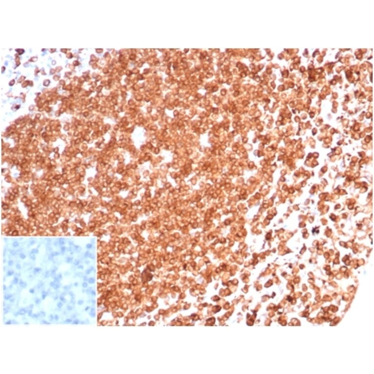 Immunohistochemistry - Anti-CD74 Antibody [CLIP/6609] (A277863) - Antibodies.com