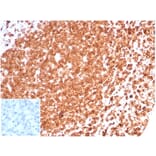 Immunohistochemistry - Anti-CD74 Antibody [CLIP/6609] (A277863) - Antibodies.com