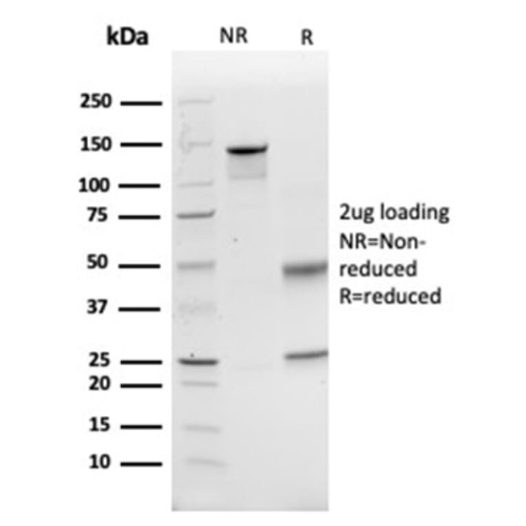 SDS-PAGE - Anti-CD74 Antibody [CLIP/6609] (A277863) - Antibodies.com