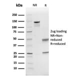 SDS-PAGE - Anti-CD74 Antibody [CLIP/6609] (A277863) - Antibodies.com