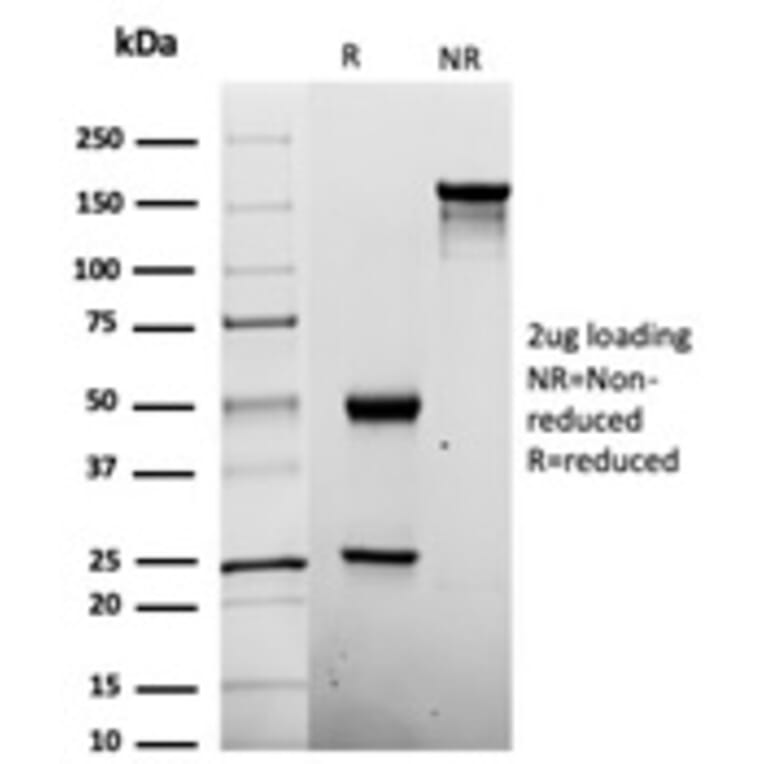 SDS-PAGE - Anti-Penicillin Antibody [Pen-9] (A277864) - Antibodies.com