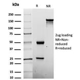 SDS-PAGE - Anti-Penicillin Antibody [Pen-9] (A277864) - Antibodies.com