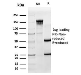 SDS-PAGE - Anti-HA Tag Antibody [HA/279] (A277865) - Antibodies.com