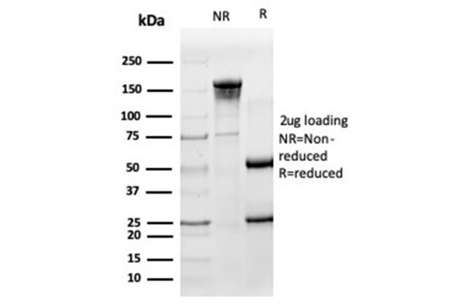 SDS-PAGE - Anti-HA Tag Antibody [HA/279] (A277865) - Antibodies.com