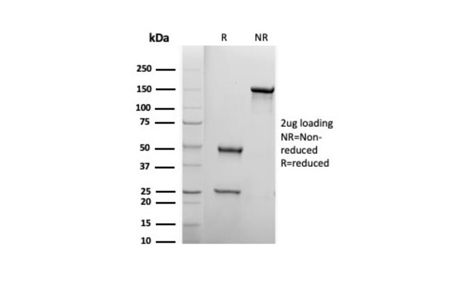 SDS-PAGE - Anti-Biotin Antibody [BTN399] (A277866) - Antibodies.com