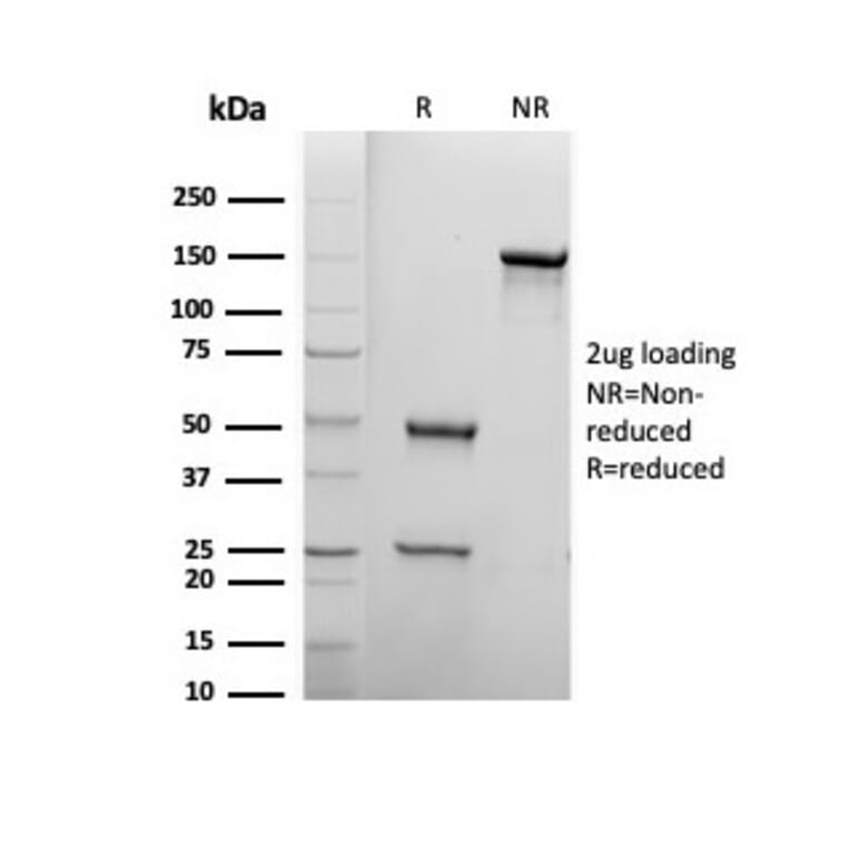 SDS-PAGE - Anti-Biotin Antibody [BTN399] (A277866) - Antibodies.com