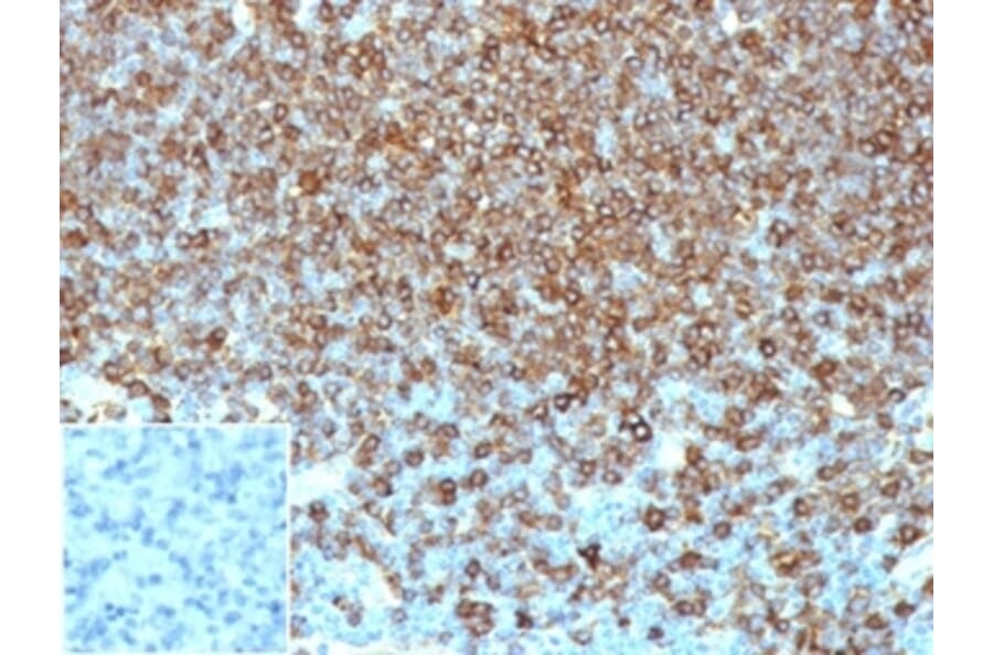 Immunohistochemistry - Anti-HLA DP + DQ + DR Antibody [HLA-Pan/6663] (A277868) - Antibodies.com