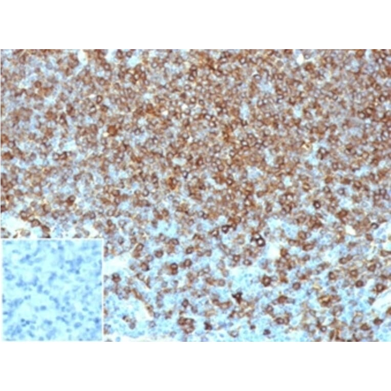 Immunohistochemistry - Anti-HLA DP + DQ + DR Antibody [HLA-Pan/6663] (A277868) - Antibodies.com