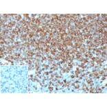 Immunohistochemistry - Anti-HLA DP + DQ + DR Antibody [HLA-Pan/6663] (A277868) - Antibodies.com