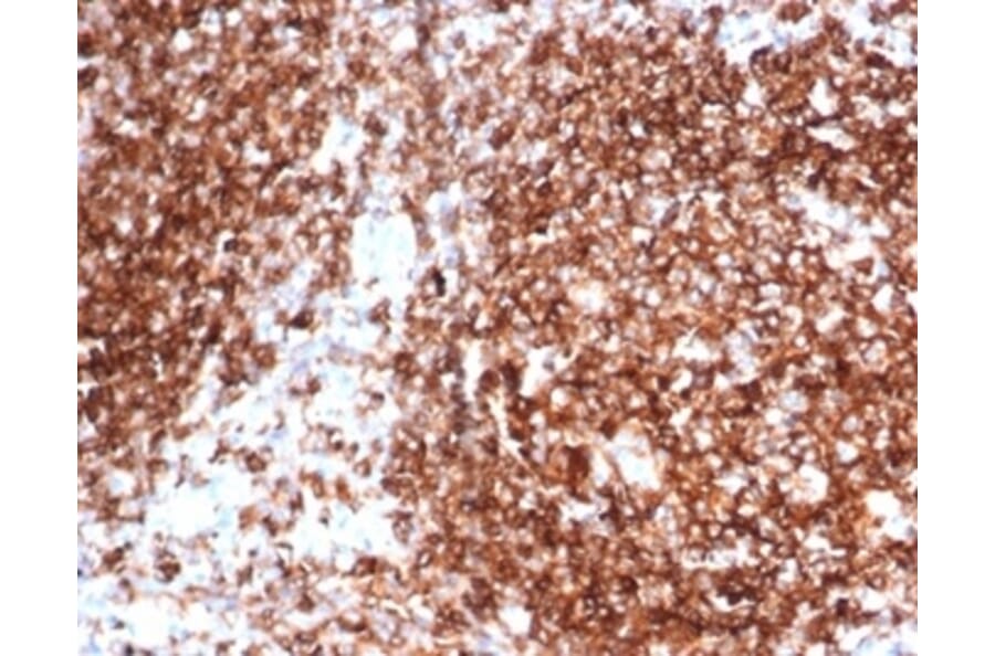 Immunohistochemistry - Anti-HLA DP + DQ + DR Antibody [HLA-Pan/6663] (A277868) - Antibodies.com