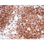Immunohistochemistry - Anti-HLA DP + DQ + DR Antibody [HLA-Pan/6663] (A277868) - Antibodies.com