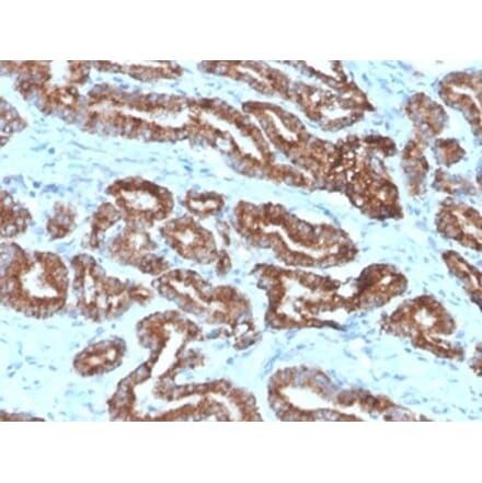 Immunohistochemistry - Anti-AMACR Antibody [13H4] (A277873) - Antibodies.com