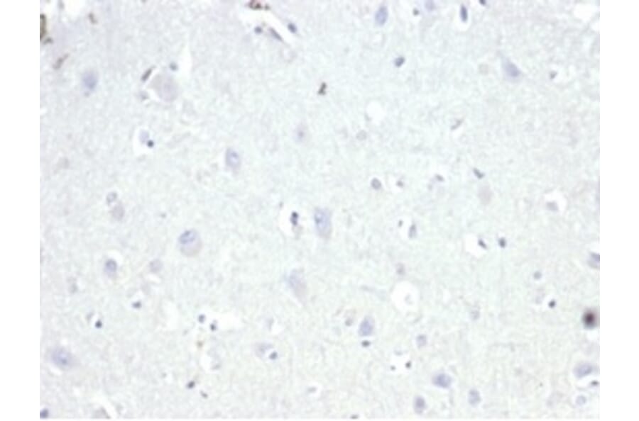 Immunohistochemistry - Anti-AMACR Antibody [13H4] (A277873) - Antibodies.com