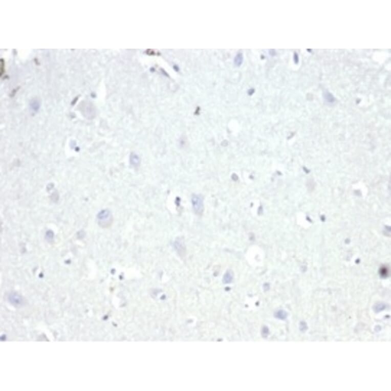 Immunohistochemistry - Anti-AMACR Antibody [13H4] (A277873) - Antibodies.com