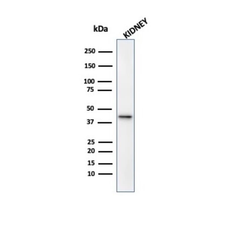 Western Blot - Anti-AMACR Antibody [13H4] (A277873) - Antibodies.com