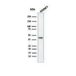 Western Blot - Anti-AMACR Antibody [13H4] (A277873) - Antibodies.com