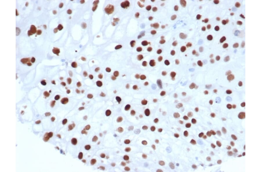 Immunohistochemistry - Anti-p21 Antibody [rCIP1/6907] (A277876) - Antibodies.com