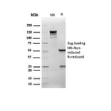 SDS-PAGE - Anti-p21 Antibody [rCIP1/6907] (A277876) - Antibodies.com