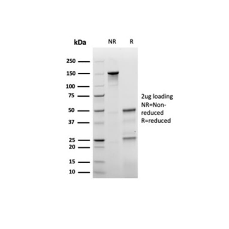 SDS-PAGE - Anti-p27 Kip1 Antibody [rKIP1/1356] (A277877) - Antibodies.com