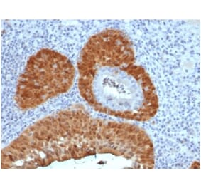 Immunohistochemistry - Anti-p16INK4a Antibody [rCDKN2A/4845] (A277878) - Antibodies.com