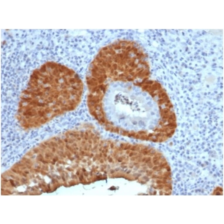 Immunohistochemistry - Anti-p16INK4a Antibody [rCDKN2A/4845] (A277878) - Antibodies.com