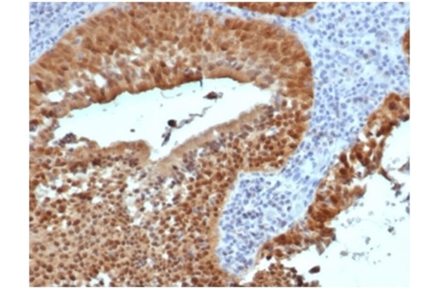 Immunohistochemistry - Anti-p16INK4a Antibody [rCDKN2A/4845] (A277878) - Antibodies.com