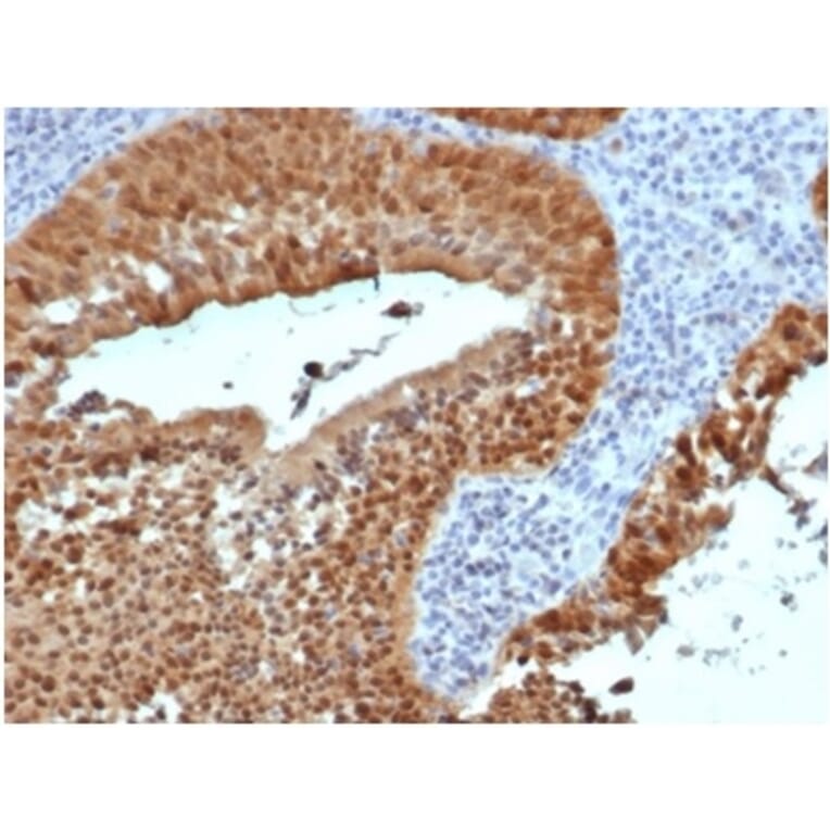 Immunohistochemistry - Anti-p16INK4a Antibody [rCDKN2A/4845] (A277878) - Antibodies.com