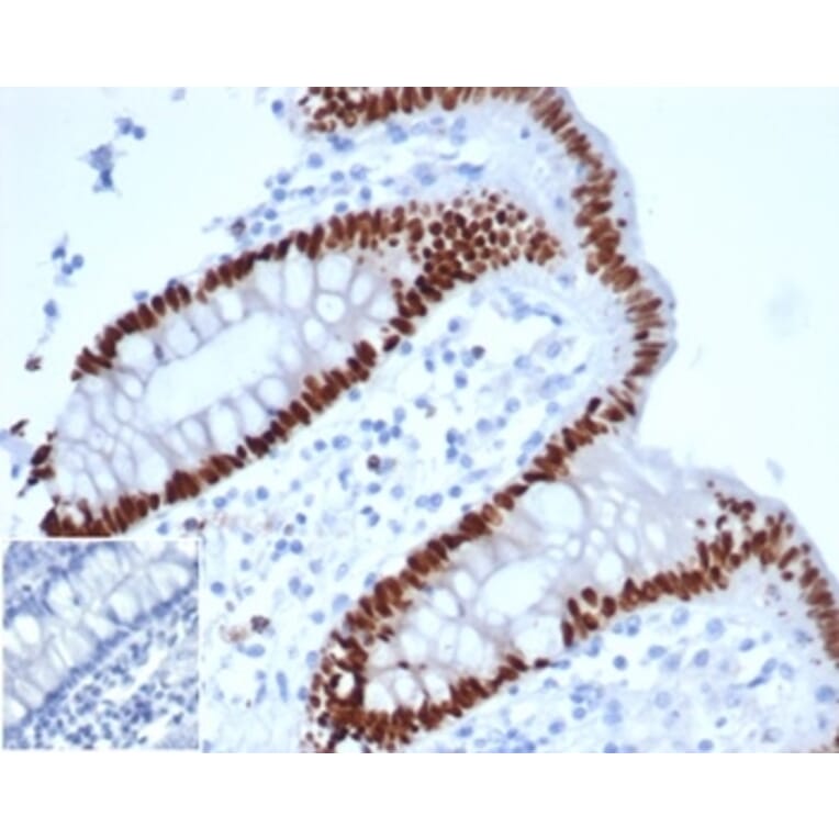 Immunohistochemistry - Anti-CDX2 Antibody [rCDX2/6921] (A277879) - Antibodies.com