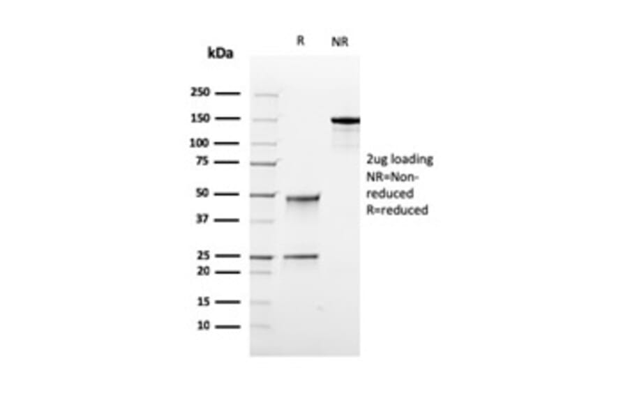 SDS-PAGE - Anti-TOP1MT Antibody [rTOP1MT/488] (A277880) - Antibodies.com