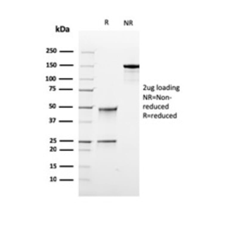 SDS-PAGE - Anti-TOP1MT Antibody [rTOP1MT/488] (A277880) - Antibodies.com