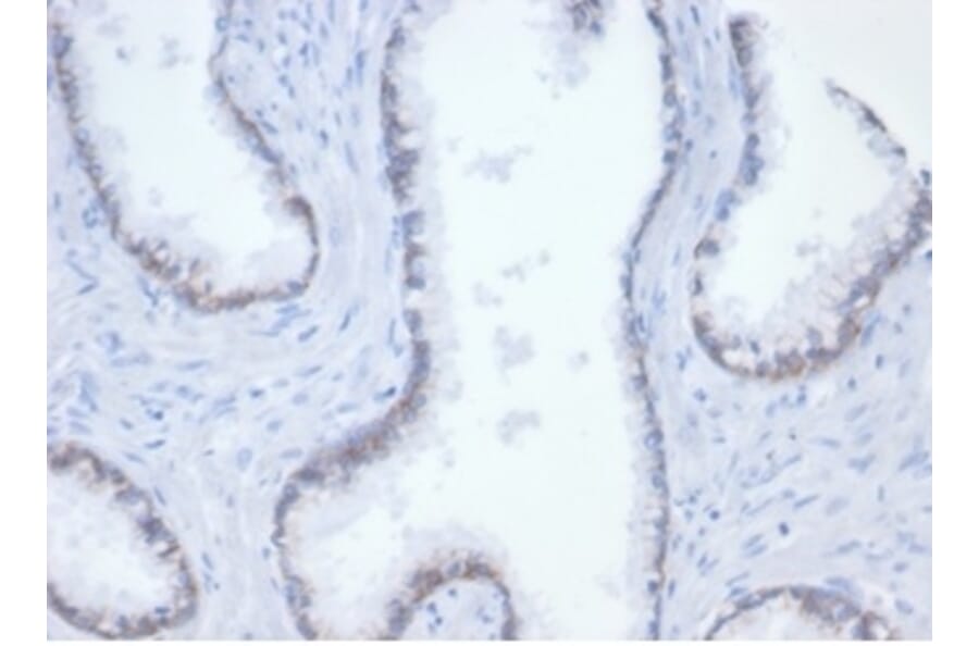 Immunohistochemistry - Anti-beta Catenin Antibody [rCTNNB1/7358] (A277881) - Antibodies.com