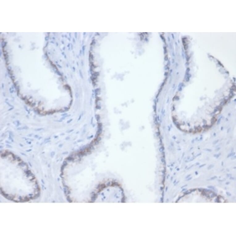 Immunohistochemistry - Anti-beta Catenin Antibody [rCTNNB1/7358] (A277881) - Antibodies.com