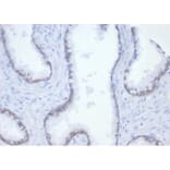 Immunohistochemistry - Anti-beta Catenin Antibody [rCTNNB1/7358] (A277881) - Antibodies.com