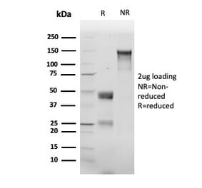 SDS-PAGE - Anti-delta 1 Catenin Antibody [rCTNND1/6903] (A277882) - Antibodies.com
