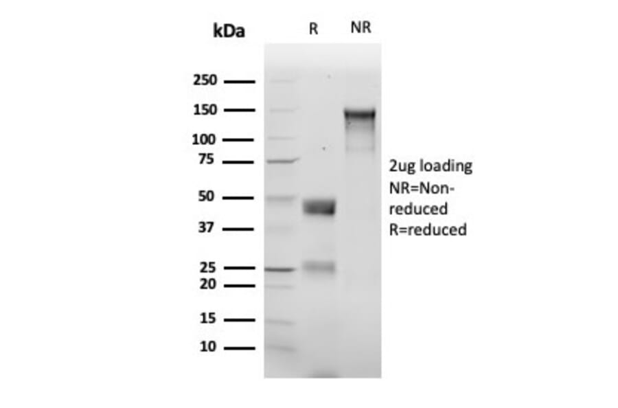 SDS-PAGE - Anti-delta 1 Catenin Antibody [rCTNND1/6903] (A277882) - Antibodies.com