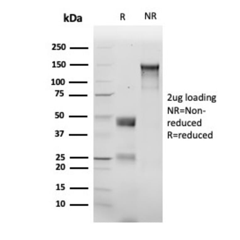 SDS-PAGE - Anti-delta 1 Catenin Antibody [rCTNND1/6903] (A277882) - Antibodies.com