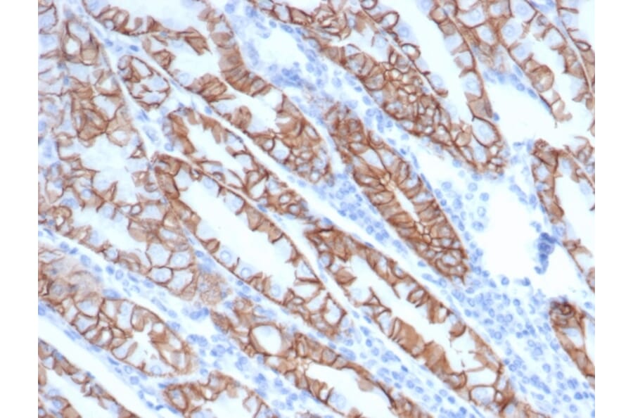 Immunohistochemistry - Anti-delta 1 Catenin Antibody [rCTNND1/6903] (A277882) - Antibodies.com