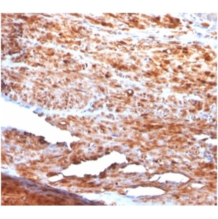 Immunohistochemistry - Anti-Desmin Antibody [rDES/1711] (A277883) - Antibodies.com