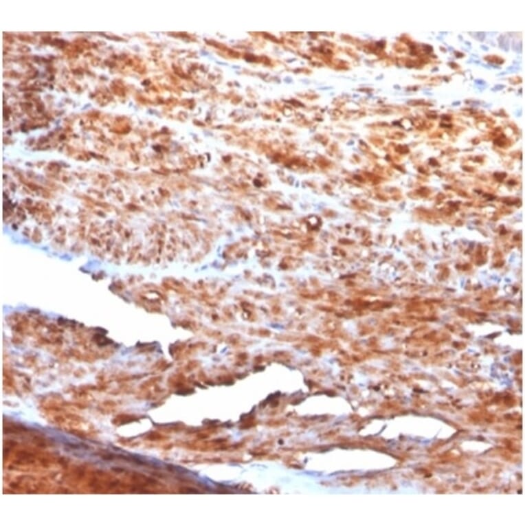 Immunohistochemistry - Anti-Desmin Antibody [rDES/1711] (A277883) - Antibodies.com