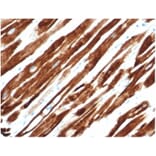 Immunohistochemistry - Anti-Desmin Antibody [rDES/1711] (A277883) - Antibodies.com