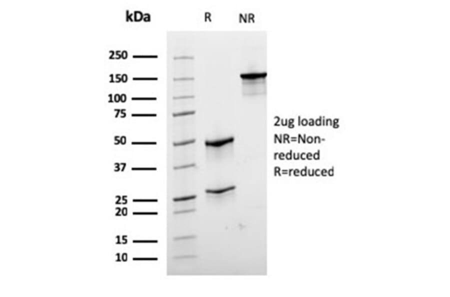 SDS-PAGE - Anti-Desmin Antibody [rDES/1711] (A277883) - Antibodies.com
