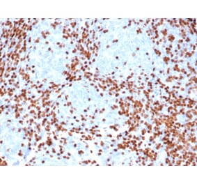 Immunohistochemistry - Anti-TdT Antibody [rDNTT/6909] (A277884) - Antibodies.com