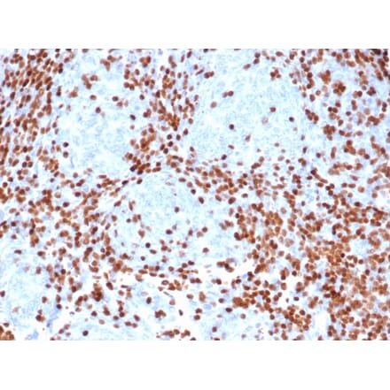 Immunohistochemistry - Anti-TdT Antibody [rDNTT/6909] (A277884) - Antibodies.com