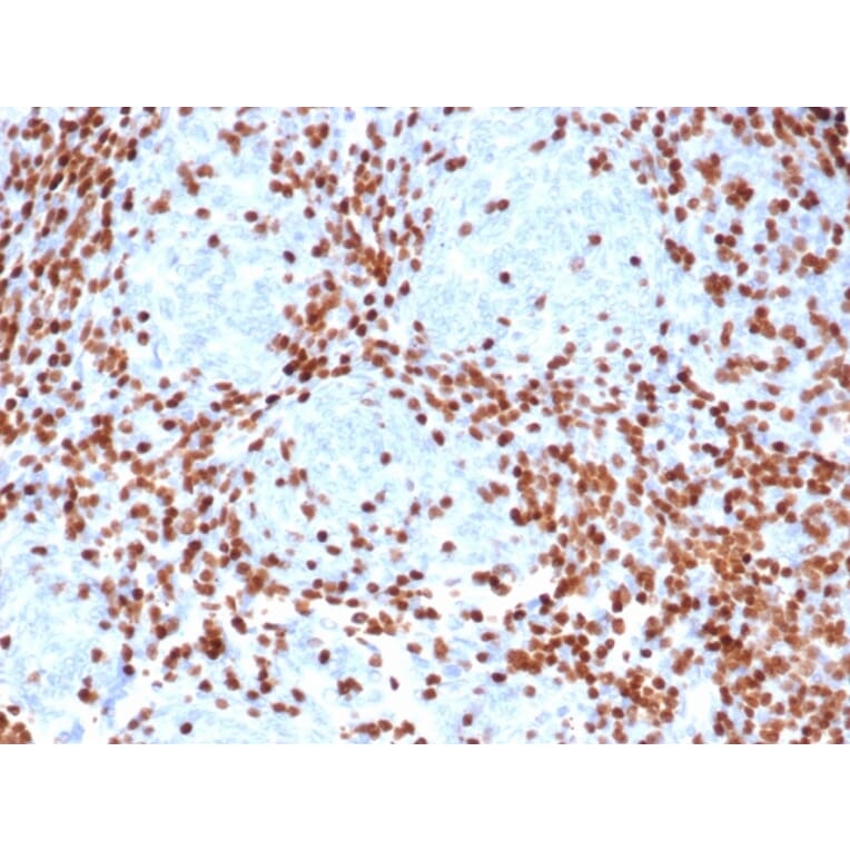 Immunohistochemistry - Anti-TdT Antibody [rDNTT/6909] (A277884) - Antibodies.com